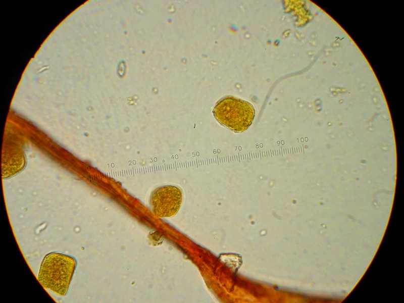 Puccinia?
