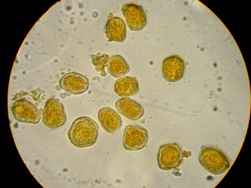Puccinia?
