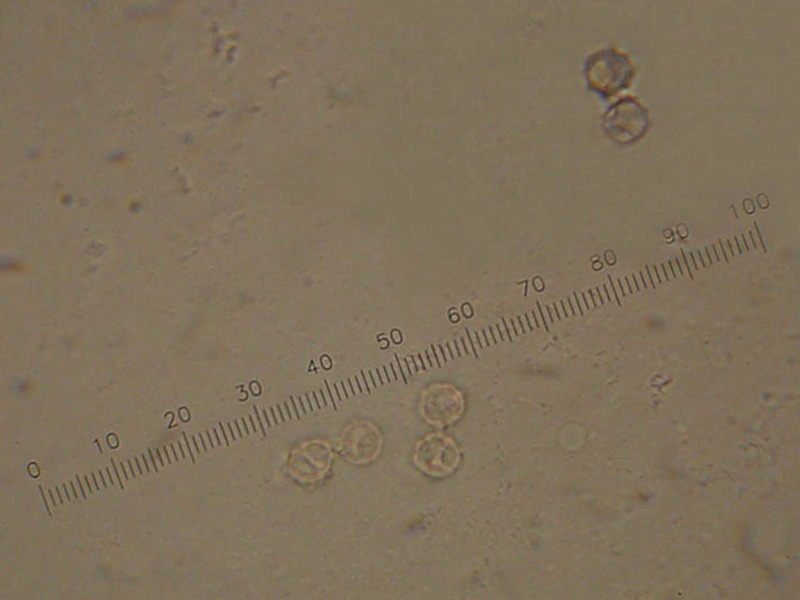 Ritrovamento del 20.04.2010.