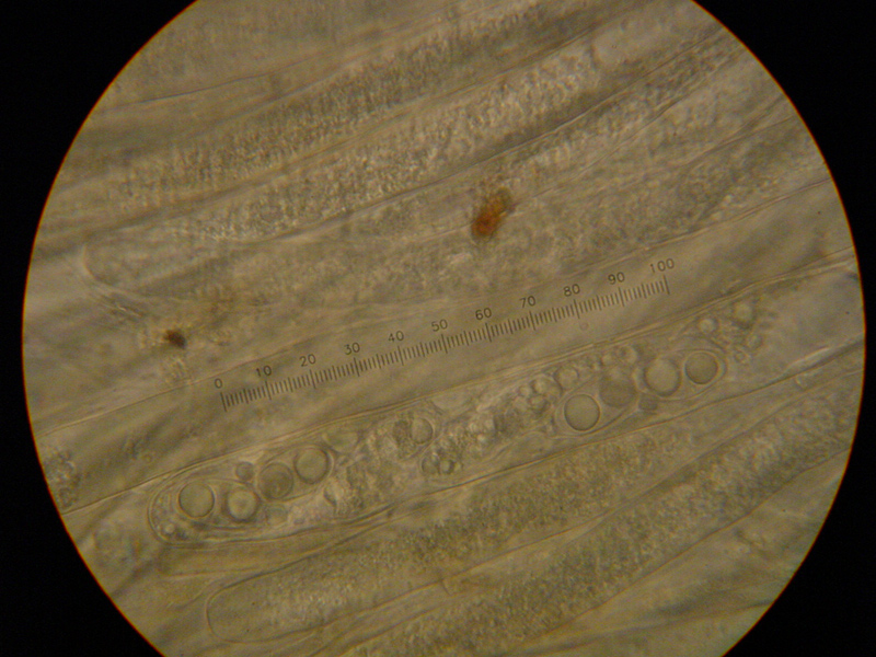 Pachyella lazzariana?