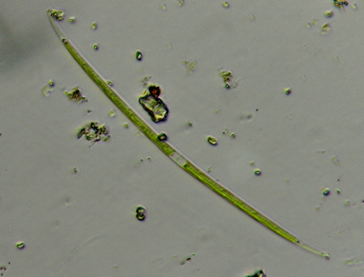 CLOSTERIUM sp.