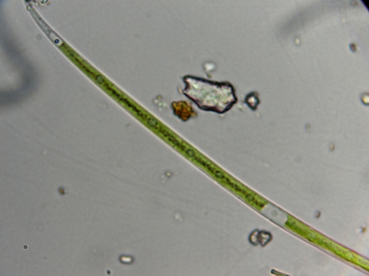 CLOSTERIUM sp.