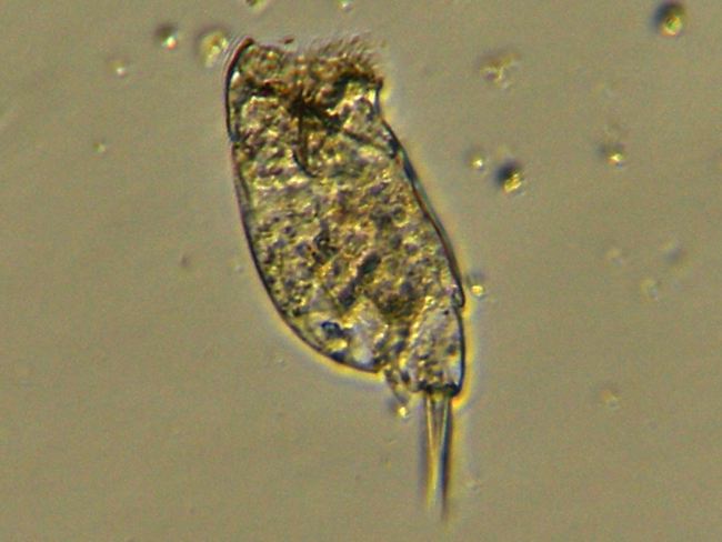 Pediatrum tetras, Cyclotella sp., Cocconeis sp.