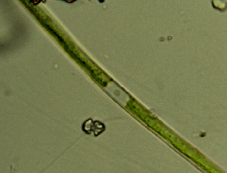 CLOSTERIUM sp.