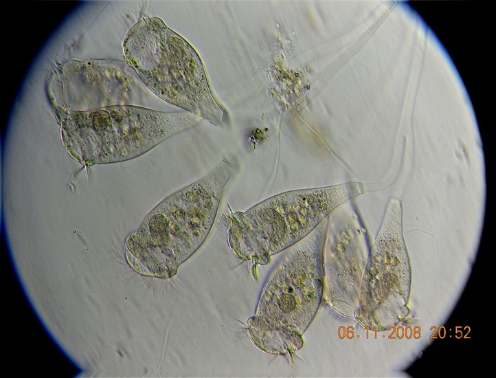 Epistylis sp.