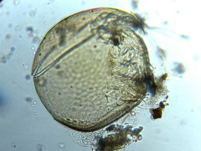 Pediatrum tetras, Cyclotella sp., Cocconeis sp.