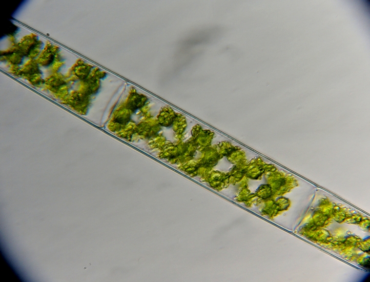 Altra Foto 1 Alga [ Spirogyra sp. ]