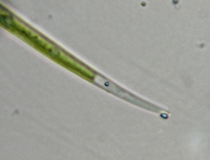 CLOSTERIUM sp.