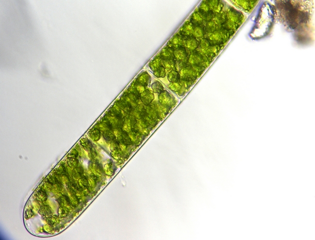 Pediatrum boryanum e Spirogyra sp.
