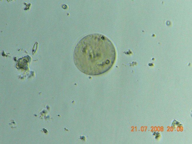 Pediatrum tetras, Cyclotella sp., Cocconeis sp.