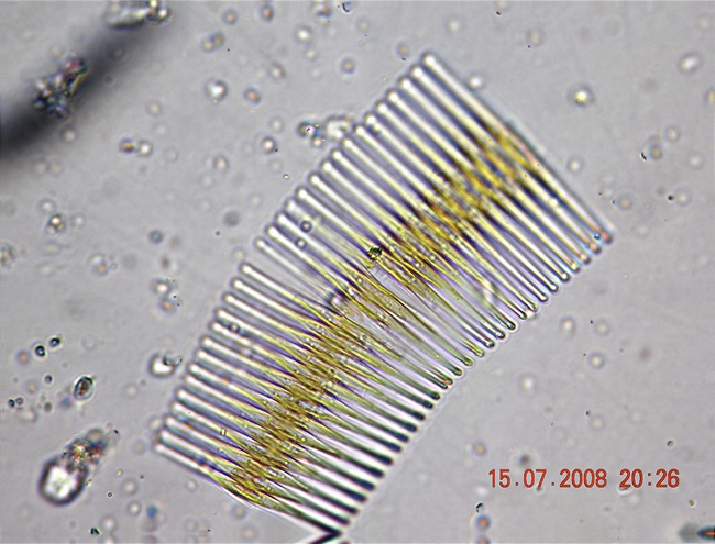 Fragilaria crotonensis