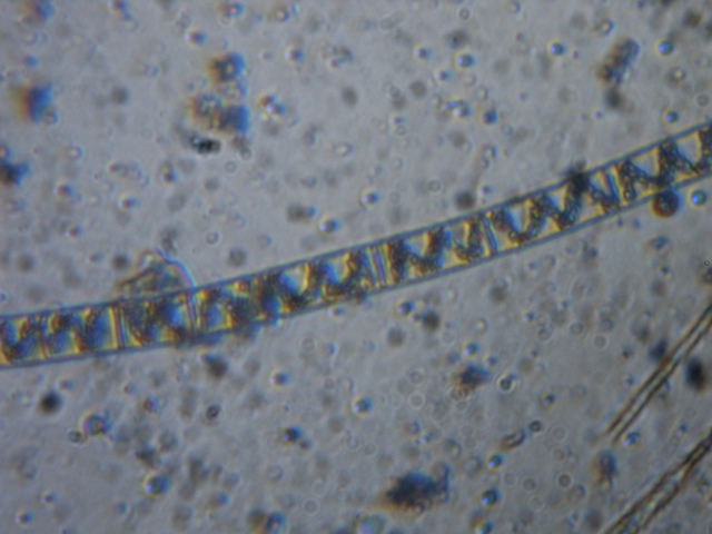 Spirogyra sp.