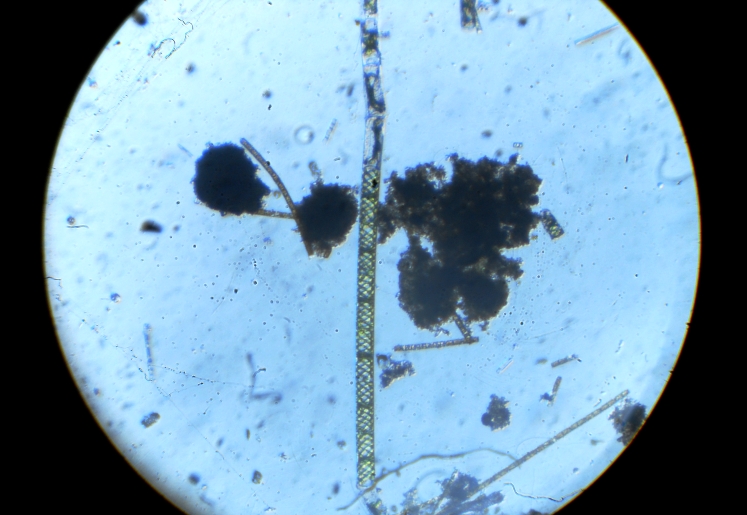 Spirogyra sp.