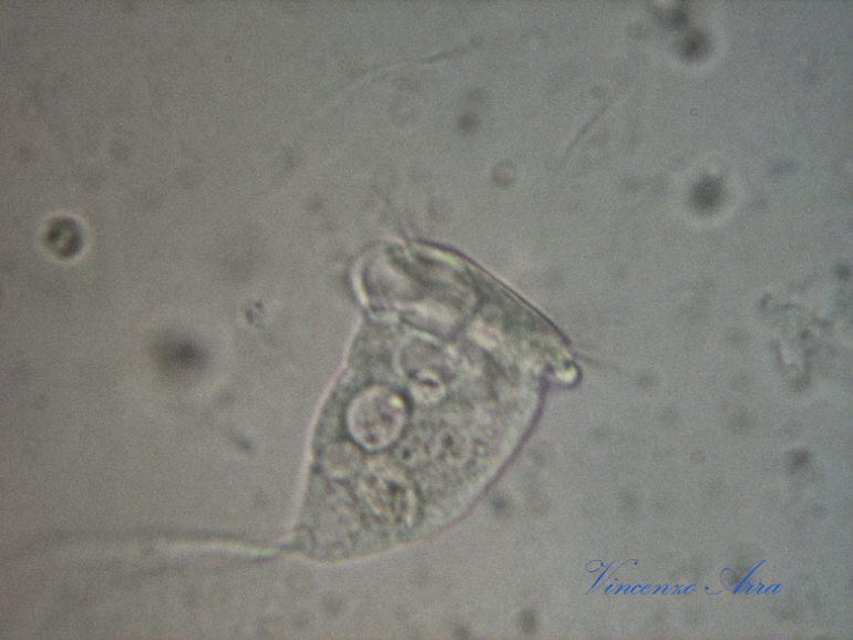 Finalmente Vorticella...