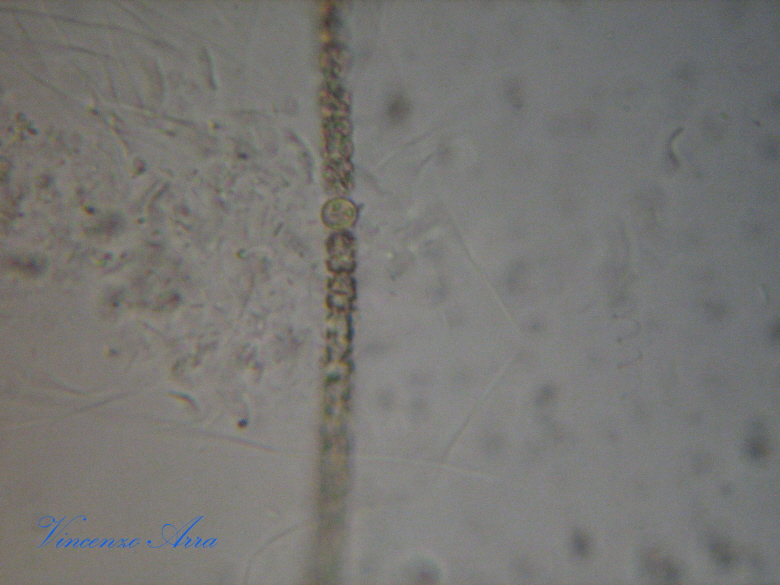 Ancora Anabaena