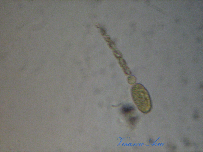 Ancora Anabaena