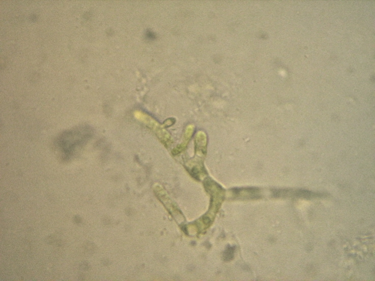 Carrellata di Chlorophyta