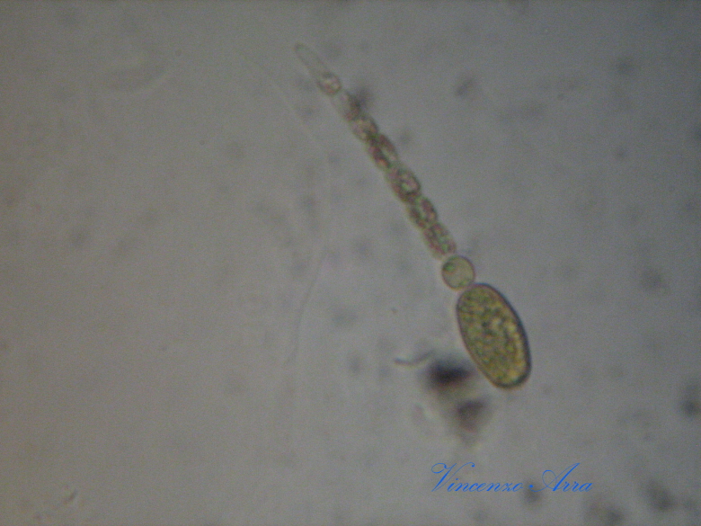 Ancora Anabaena