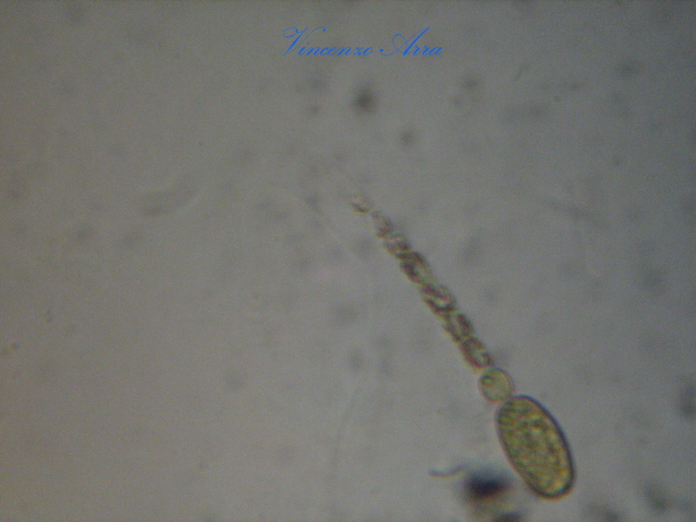 Ancora Anabaena