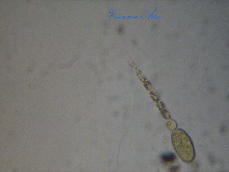 Ancora Anabaena
