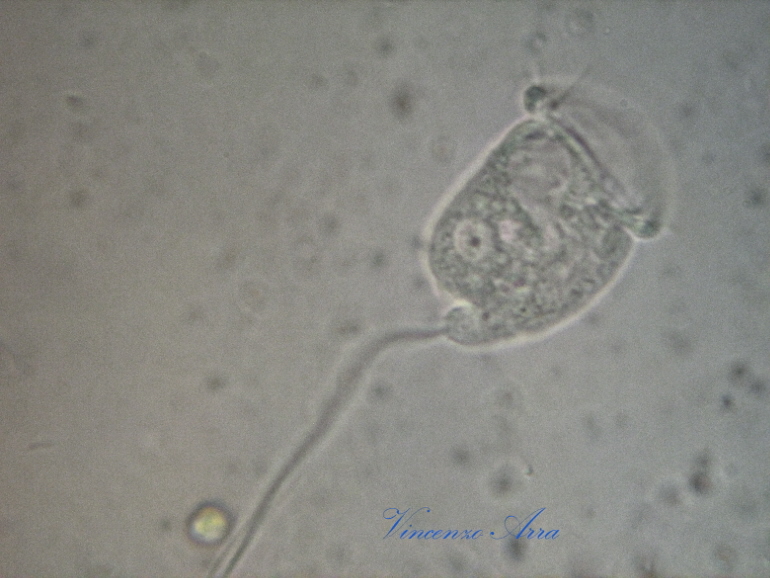 Finalmente Vorticella...
