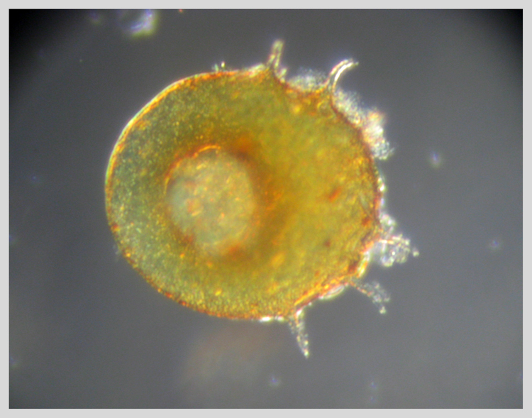 Centropyxis aculeata anch''io