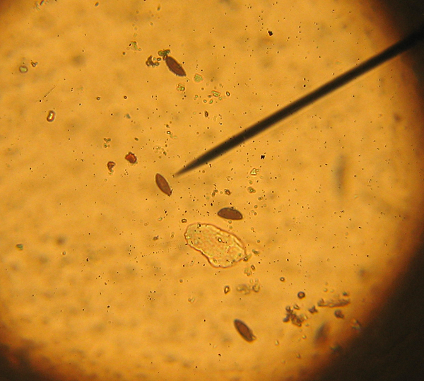 Fungo da riconoscere (cfr. Hypoxylon sp.)