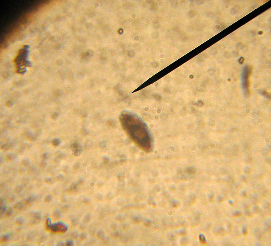 Fungo da riconoscere (cfr. Hypoxylon sp.)