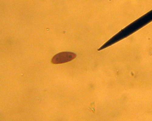 Fungo da riconoscere (cfr. Hypoxylon sp.)