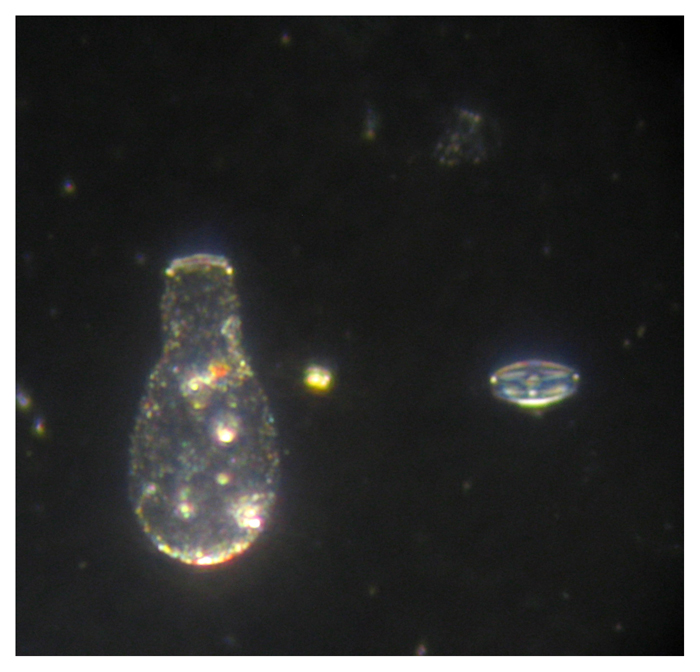 Tecameba: Nebela lageniformis