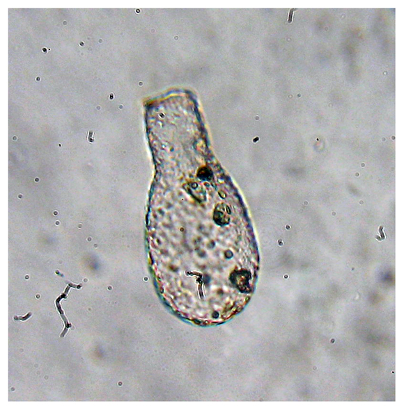 Tecameba: Nebela lageniformis
