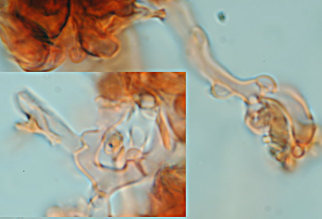 Quale Peniophora? (Peniophora lycii )