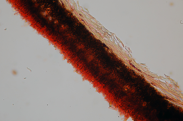 Quale Peniophora? (Peniophora lycii )
