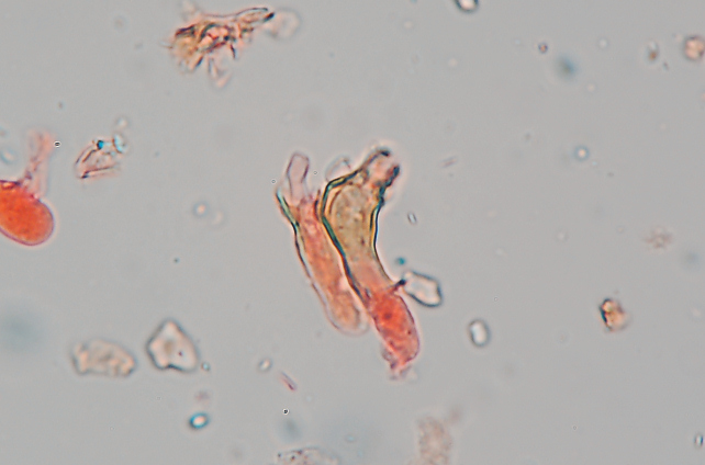 Quale Peniophora? (Peniophora lycii )