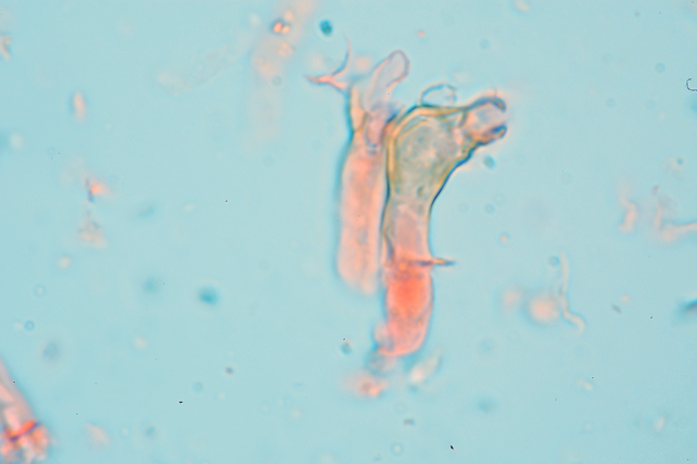 Quale Peniophora? (Peniophora lycii )