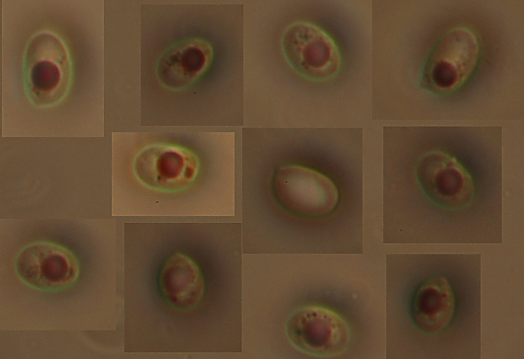 Quale Hyphoderma? (H. praetermissum?)