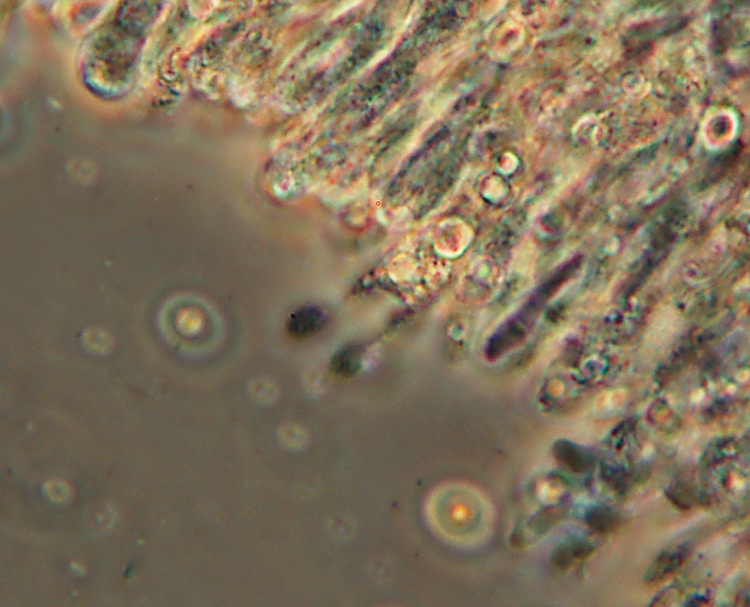 Hyphoderma cremeoalbum? (Hyphoderma cremeoalbum)