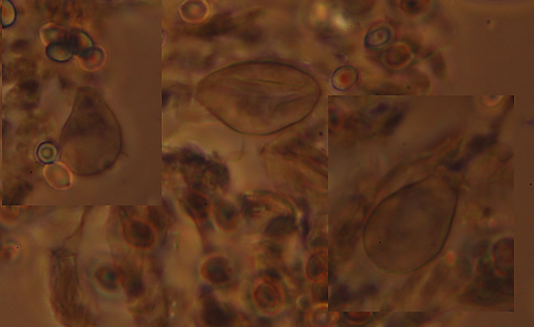 A. xantoderma?