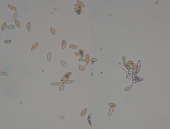 Forse nemmeno una crosta - foto 3364 (Haplotrichum aureum)