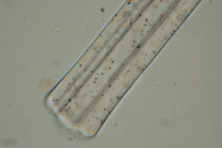 Ed io cosa sono? (Sarcoscypha)