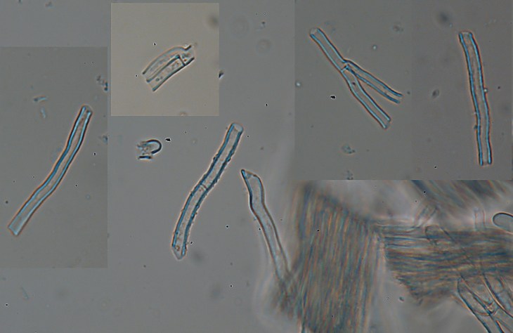 Lignicolo da determinare (Irpex lacteus)