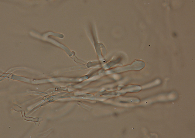 lignicolo da determinare (Hyphoderma radula)