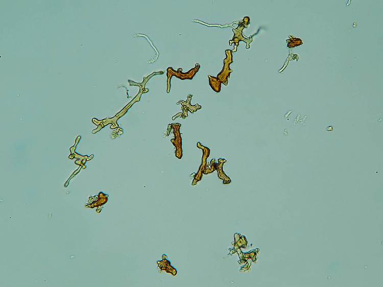 Micro-quiz