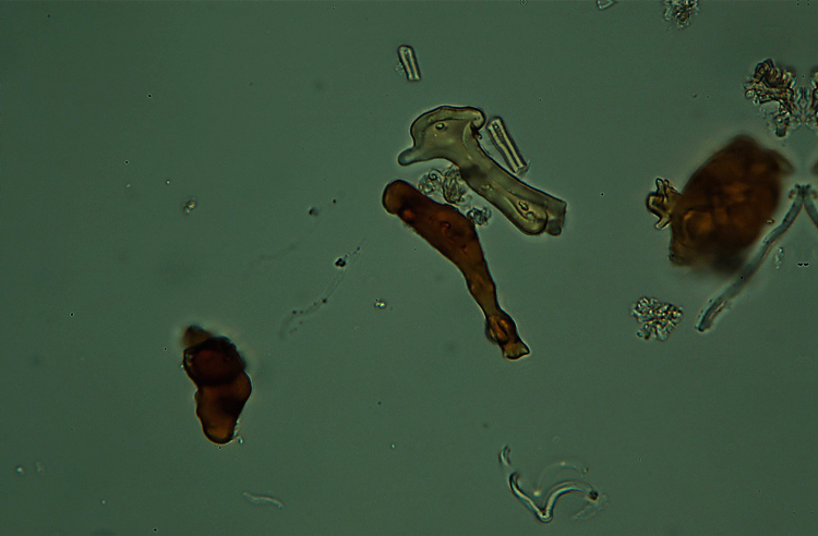 Micro-quiz