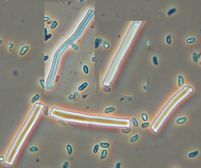 Lignicolo giallo da determinare (Stereum hirsutum)