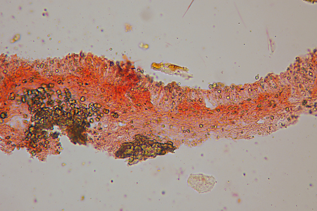 Radulomyces confluens