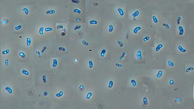 Lignicolo da determinare (Merulius tremellosus)