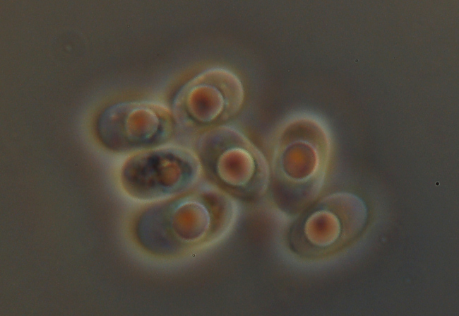 Quale Hyphoderma? (H. praetermissum?)