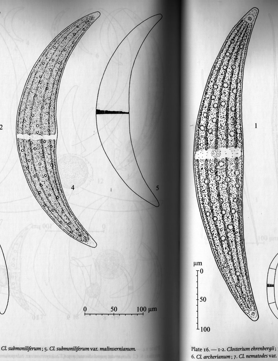 Closterium sp. (Closteriaceae)