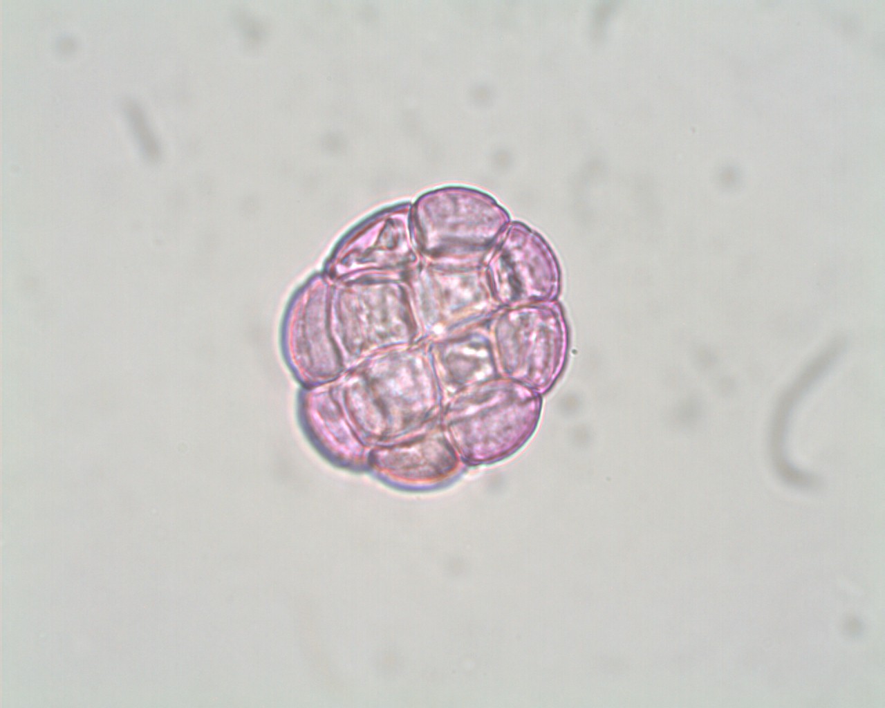 Polline di Acacia sp.